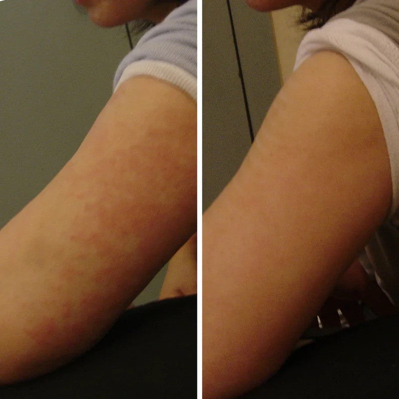 Dry skin: end discomfort - secrets to deep hydration and regeneration