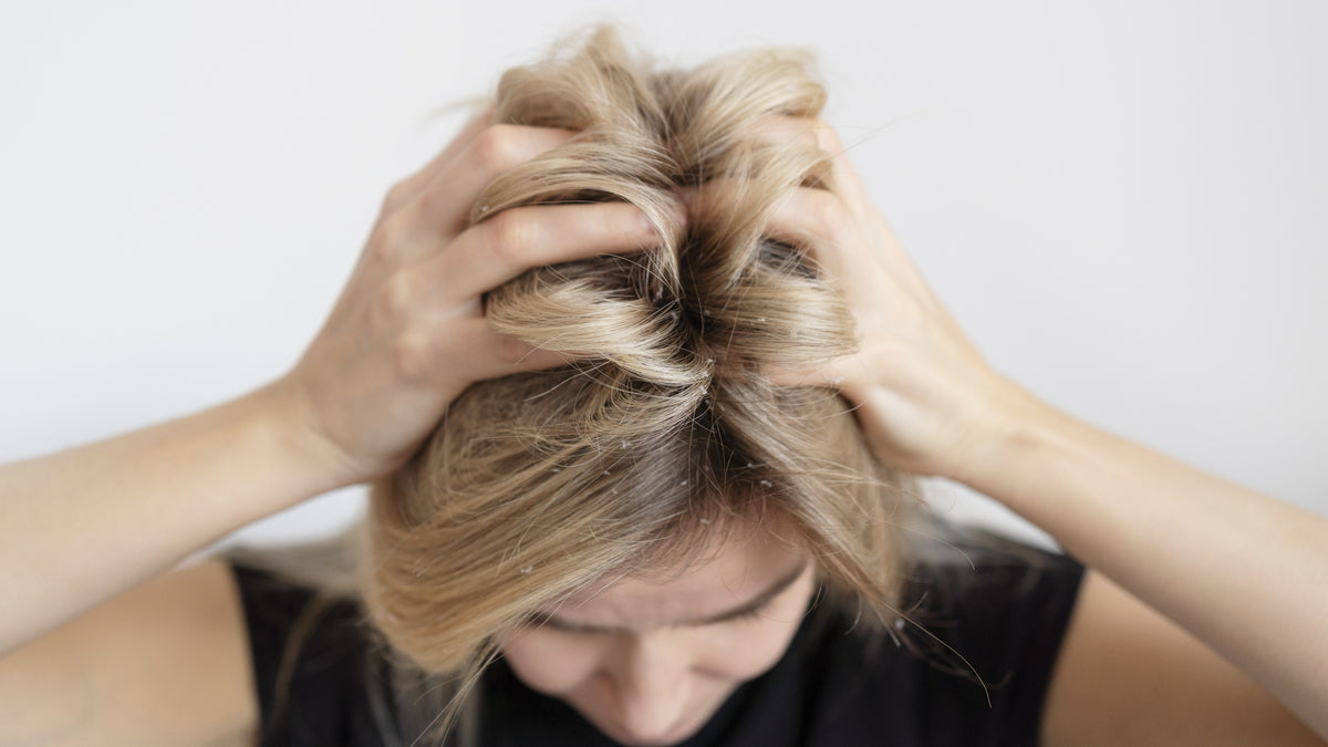 A woman with scalp eczema is scratching her head.