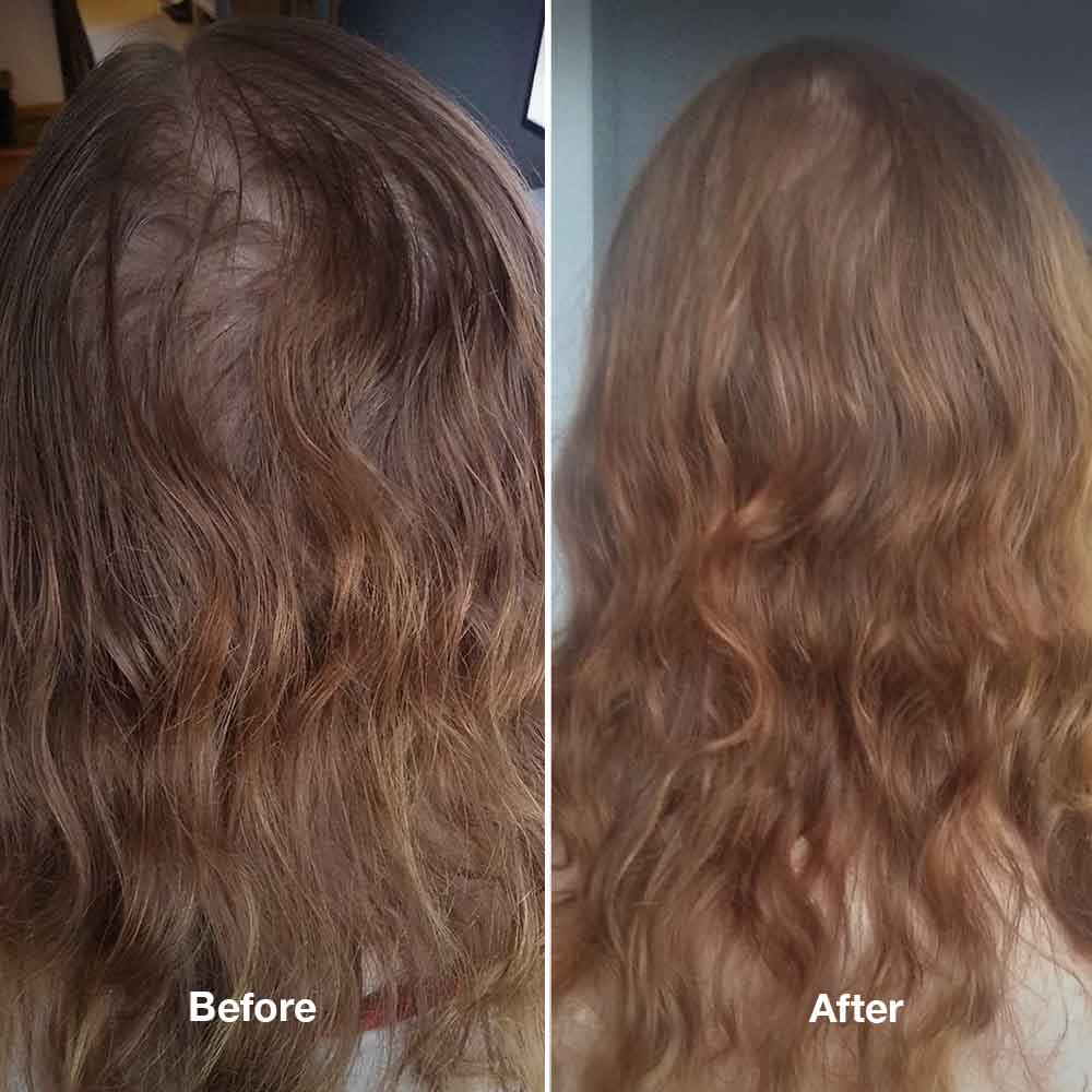 4-Step HairLXR Set + FREE Head Brush