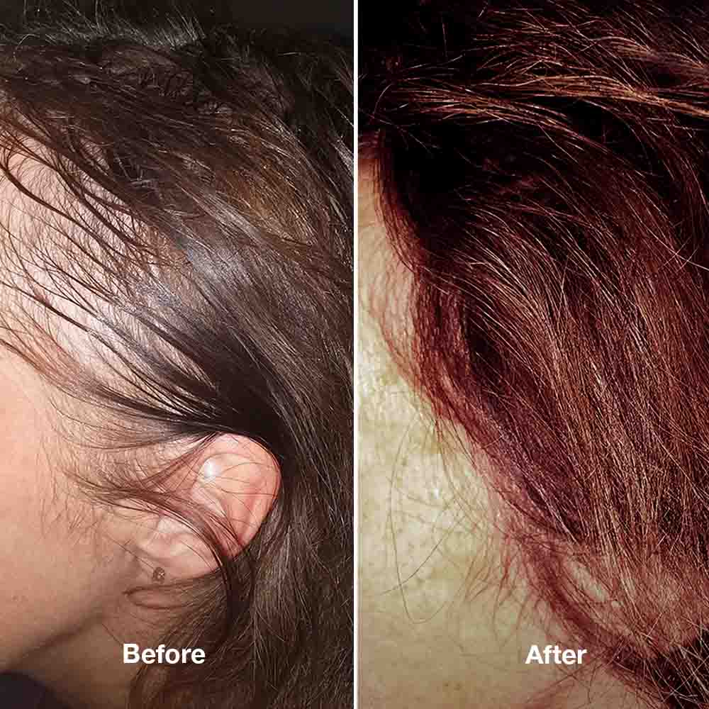 4-Step HairLXR Set + FREE Head Brush