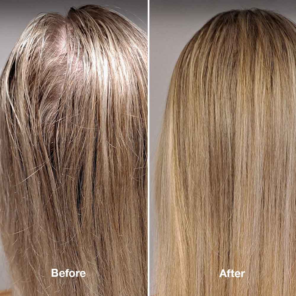 4-Step HairLXR Set + FREE Head Brush