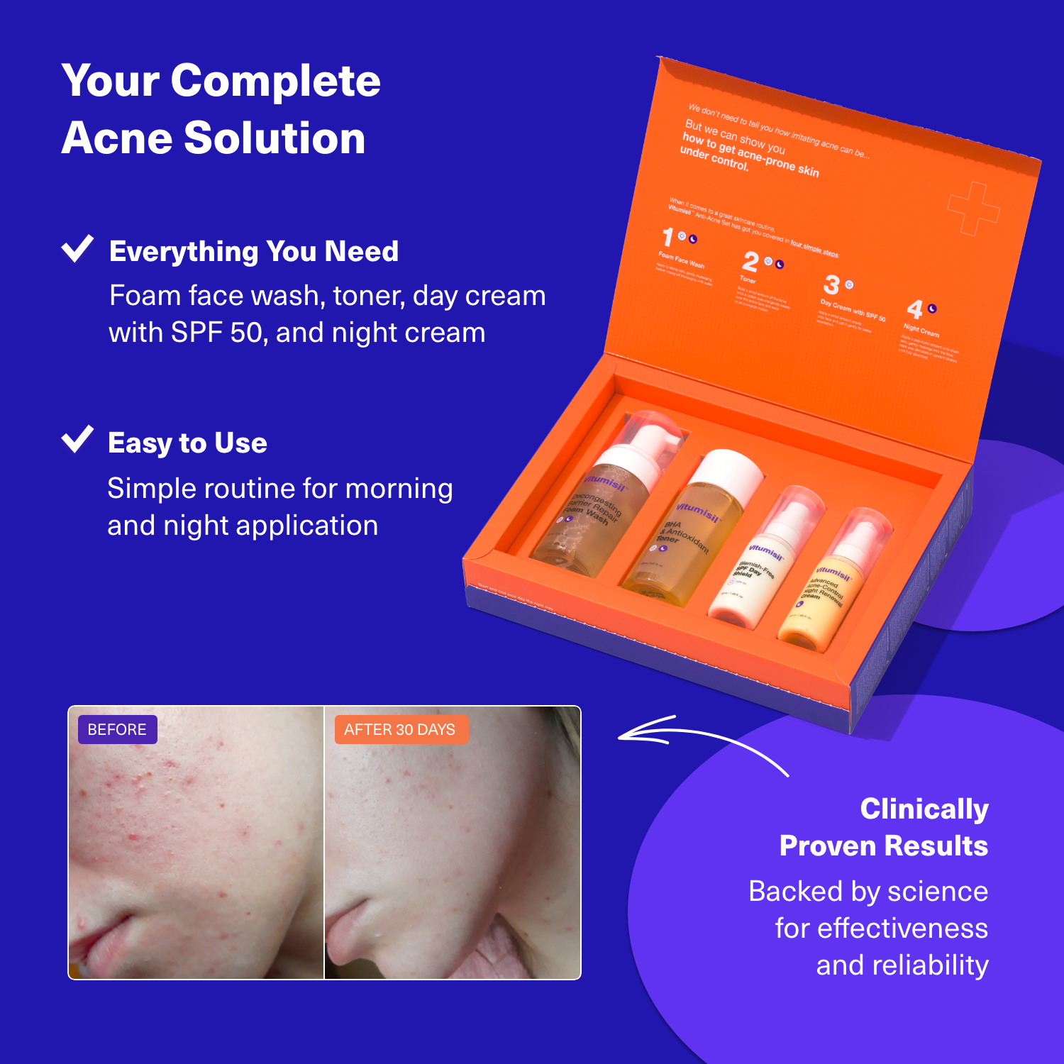 | infographic