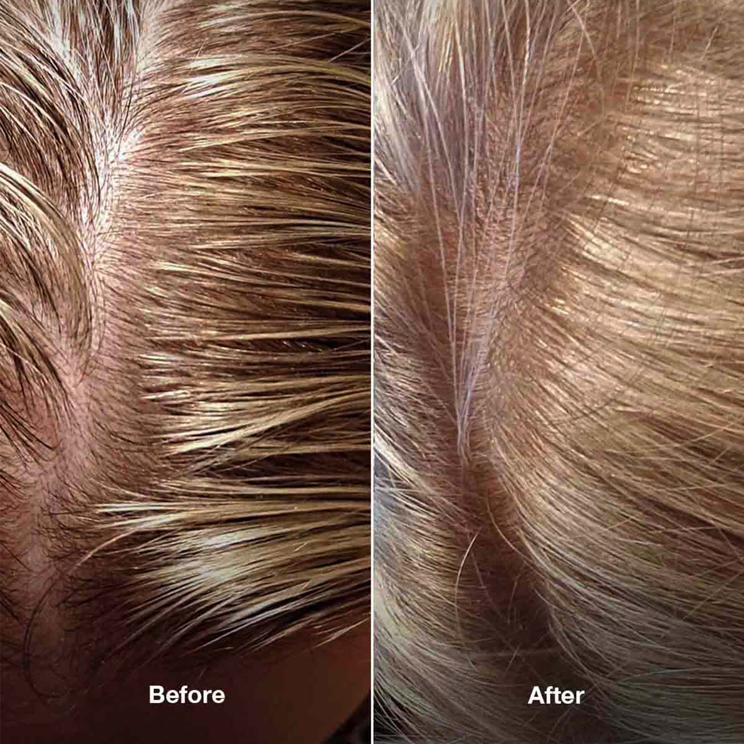 4-Step HairLXR Set + FREE Head Brush