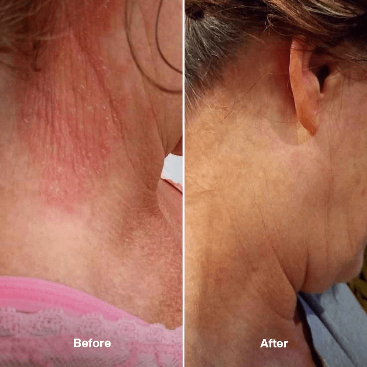 Healpsorin Emollient Balm