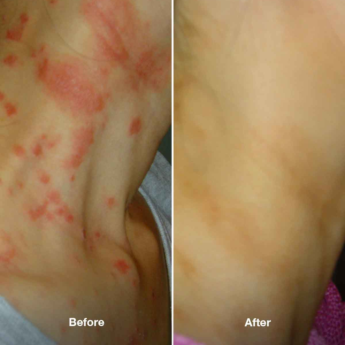 Healpsorin Emollient Balm